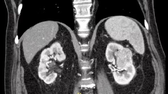 Stein-fig2