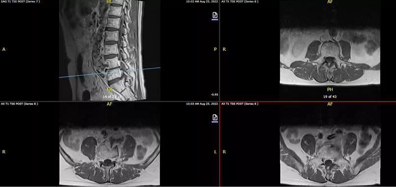 four imaging studies of a human spine