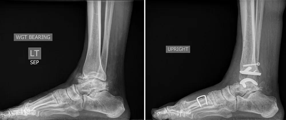 X-ray scans of the foot and ankle.