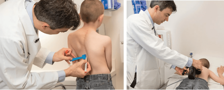 Photos of Dr. Goodwin with the recipient of the first magnetic growing rod implanted at Cleveland Clinic, taken at a post-implantation follow-up visit. In the first photo, the patient’s back is marked to guide placement of the magnetic growing rod’s magnetic actuator on the skin (second photo) to enable painless lengthening of the rod in the office.