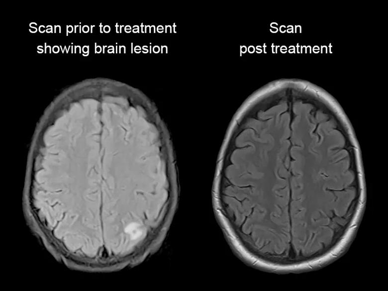 Before and after scan