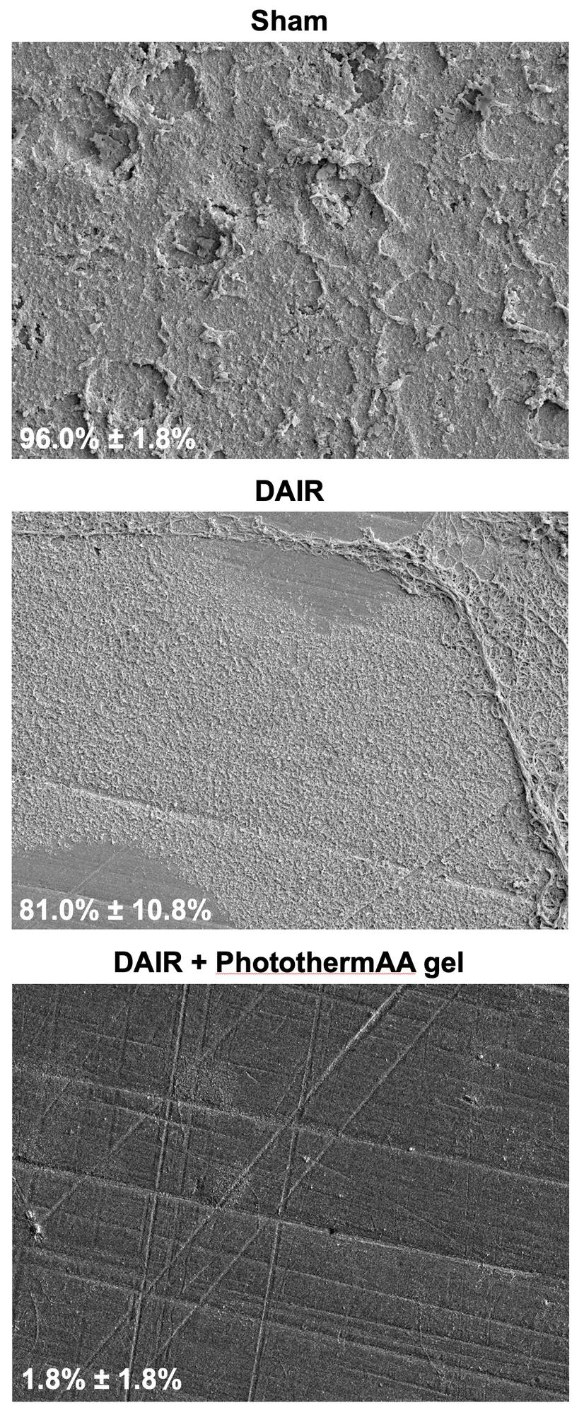 3 images of bacterial biofilm, comparing sham with standard and investigational treatments