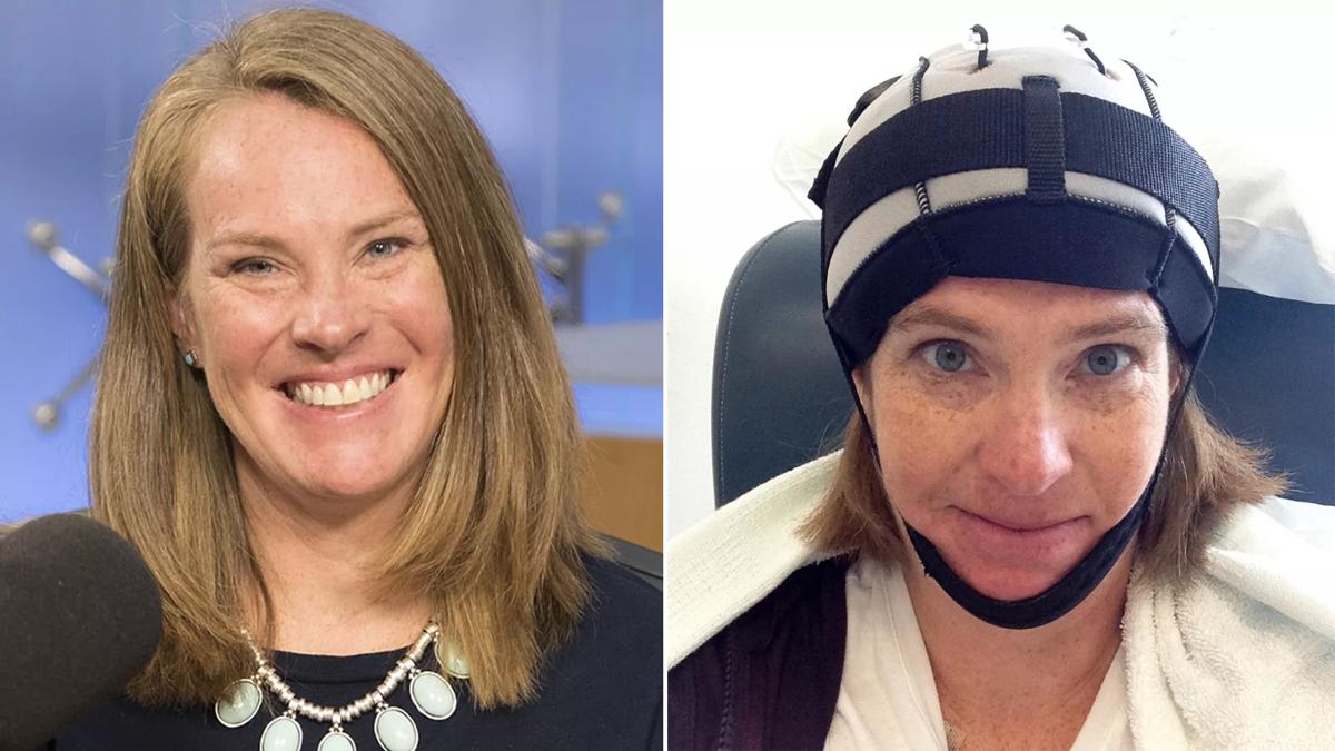 Cleveland-Clinic-Cooling-Cap-Breast-Cancer