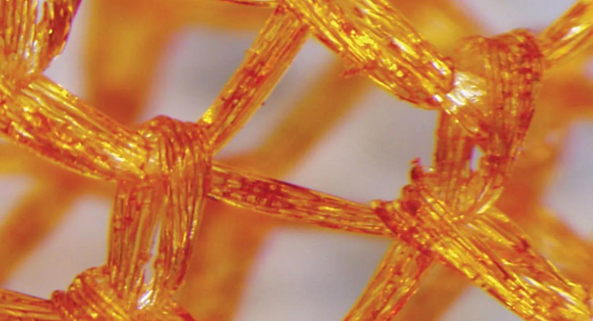 Figure. The antibacterial envelope is woven from filament that holds the CIED in place while eluting antibiotics for several days before eventually being absorbed by the body. Images (including image at top of post) courtesy of Medtronic.
