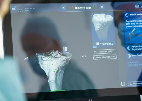 Cleveland Clinic London augmented reality total knee replacement surgery