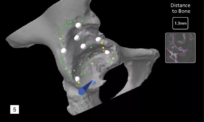 Hip scan