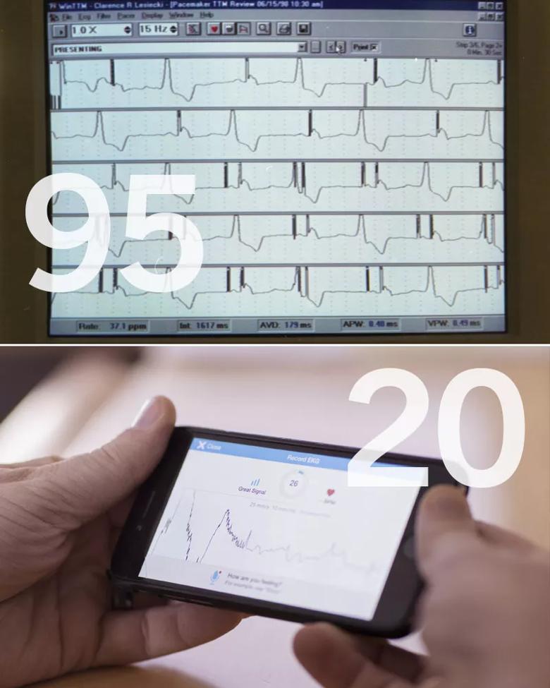 Heart rhythm monitors