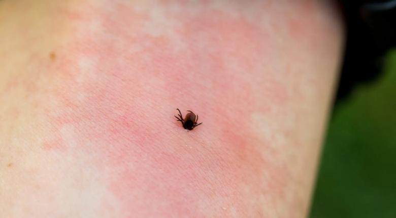 closeup of a tick burrowing on a person