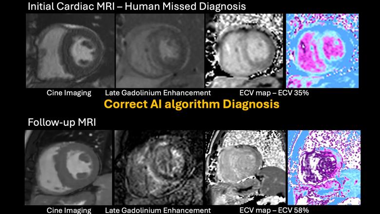 series of cardiac MRI scans