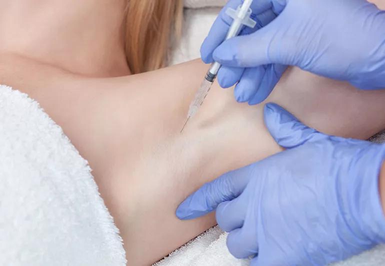 Botox for Sweating: Does it Work?