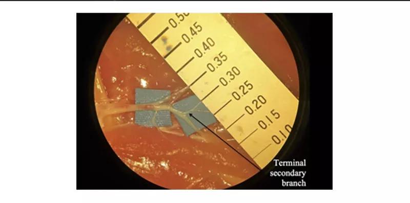 MIcrosurgery