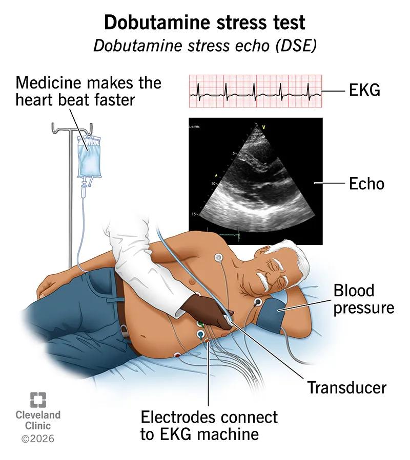 Person undergoing dobutamine stress test, lying on left side, with EKG electrodes, and provider capturing echo images