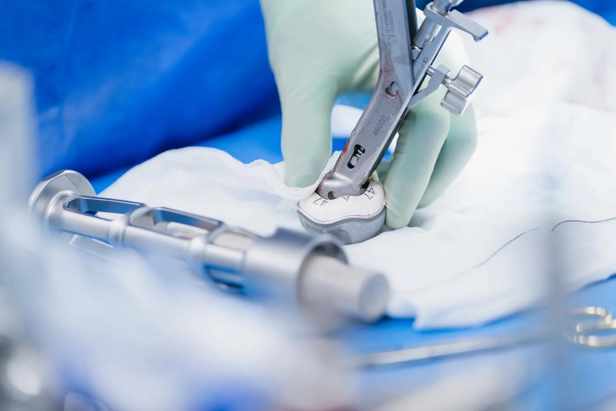 Ceramic hip resurfacing implant