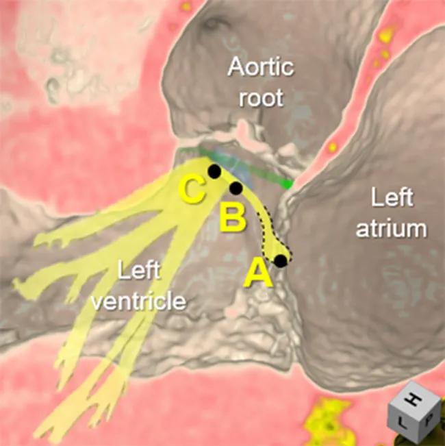 rendering of conduction system 