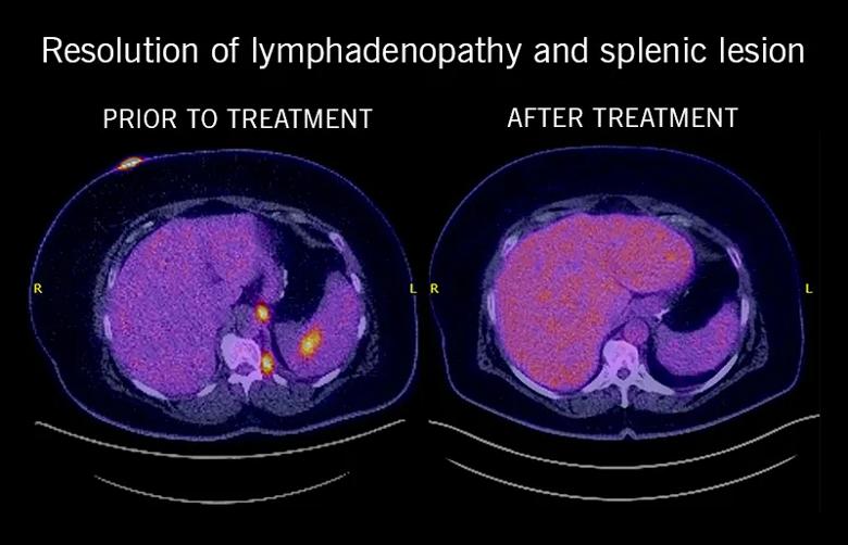 Before and after scans