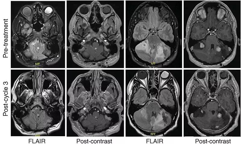eight brain scans presented across two rows