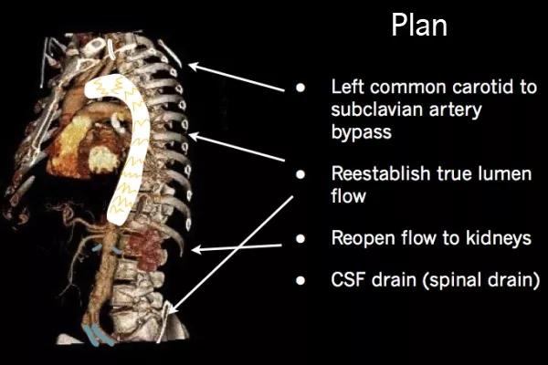 Figure 2. The operative plan.