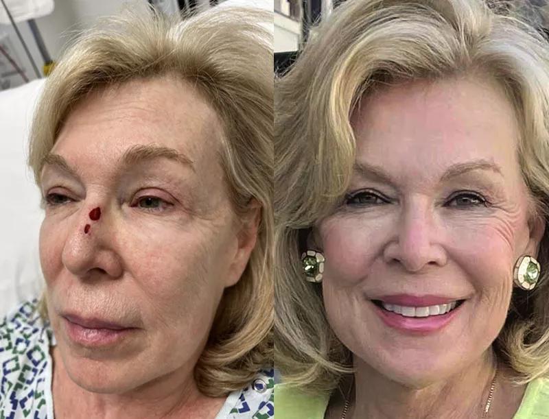 Before and after of patient