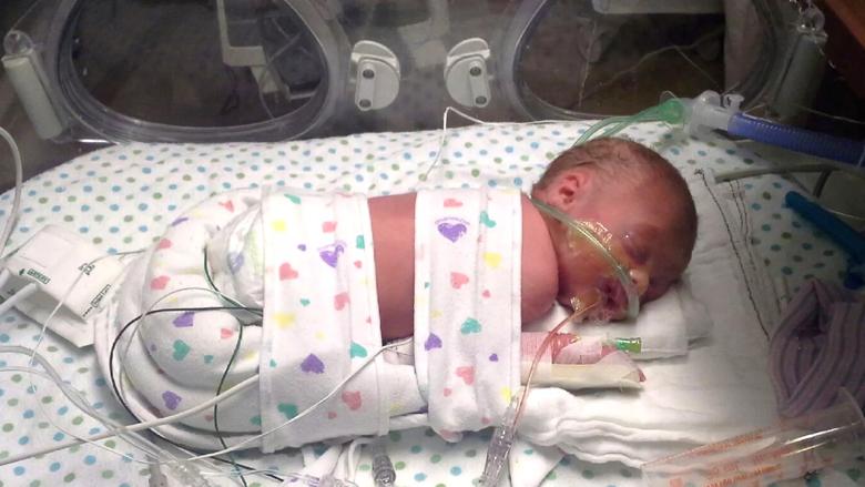 Cleveland-Clinic-Childrens-NICU