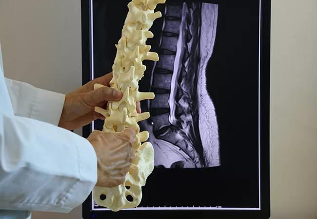 New Term Proposed for Persistent Back Pain