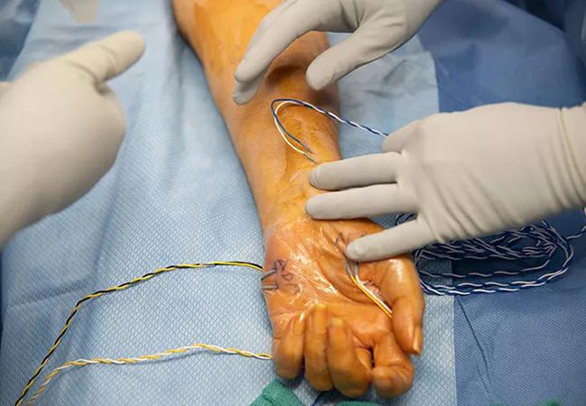 Nerve surgery