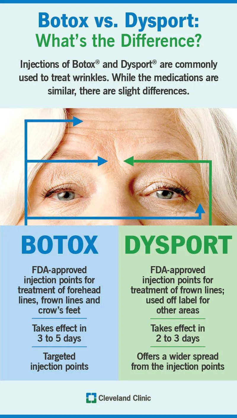 The difference between Botox and Dysport