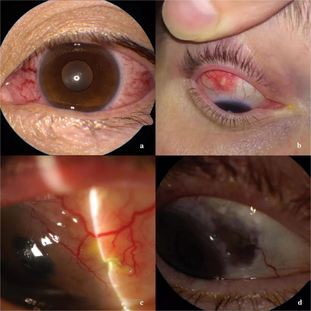 Eyes