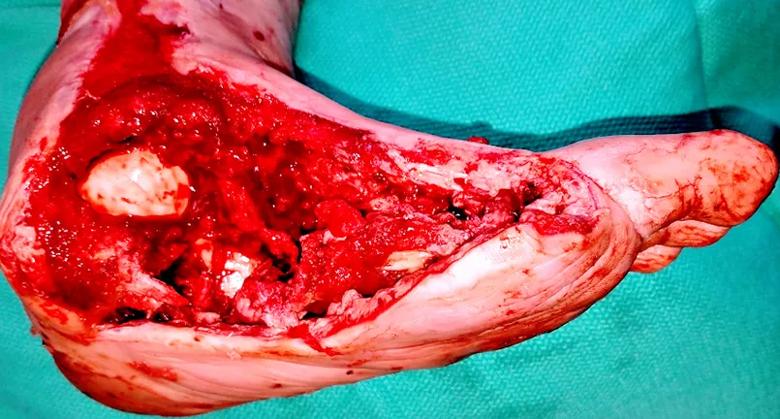 Foot