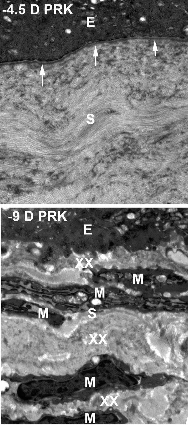 16-eye-2697-corneal-healing-cqd-inset