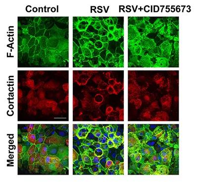 Inset-2-RSV
