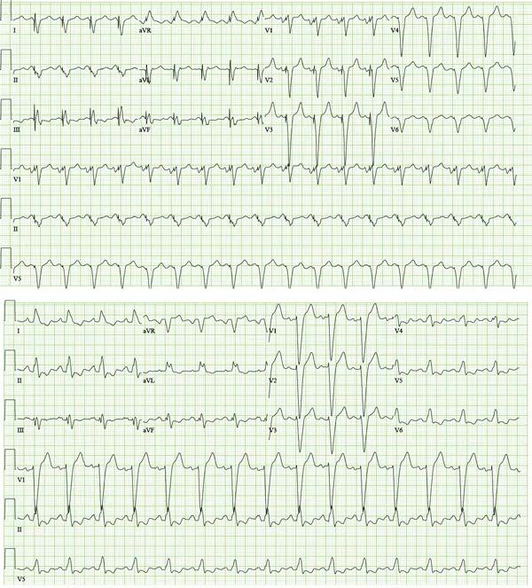 Nonresponse to CRT: A Case Study in Systematic Troubleshooting