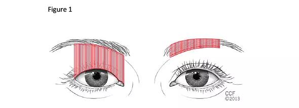 590x-Inset-1