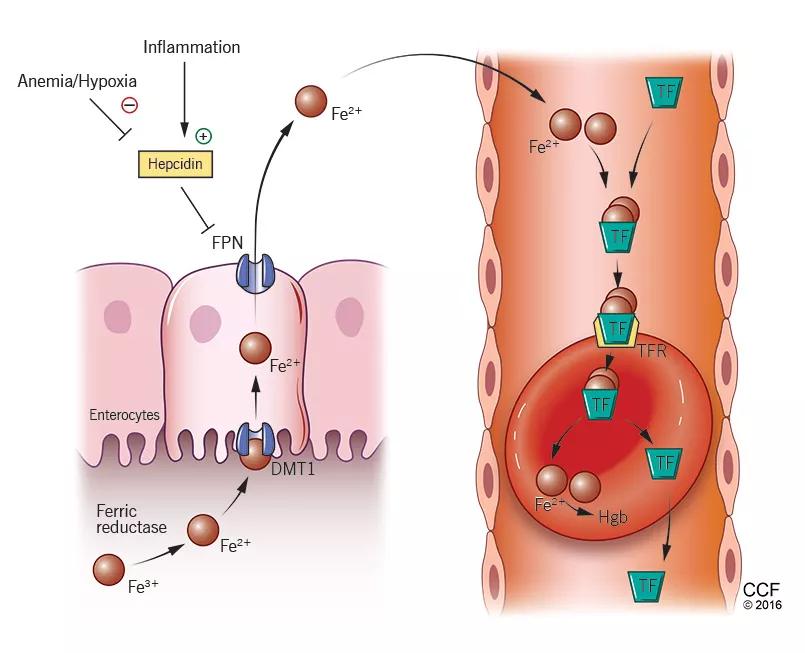 Anemia