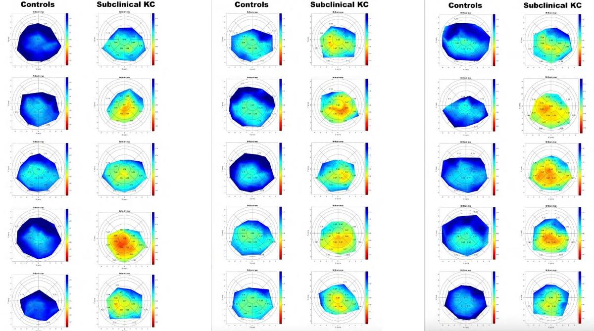 Motion-tracking Brillouin maps