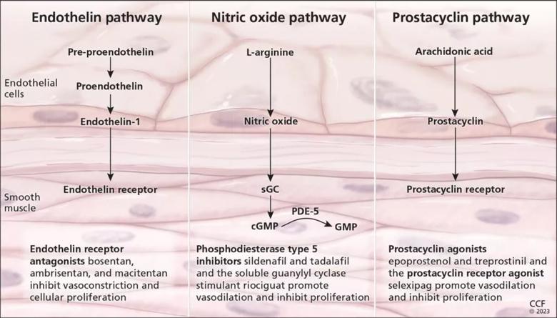Endothelin Pathway, Nitric Oxide pathway, Prostacyclin pathway
