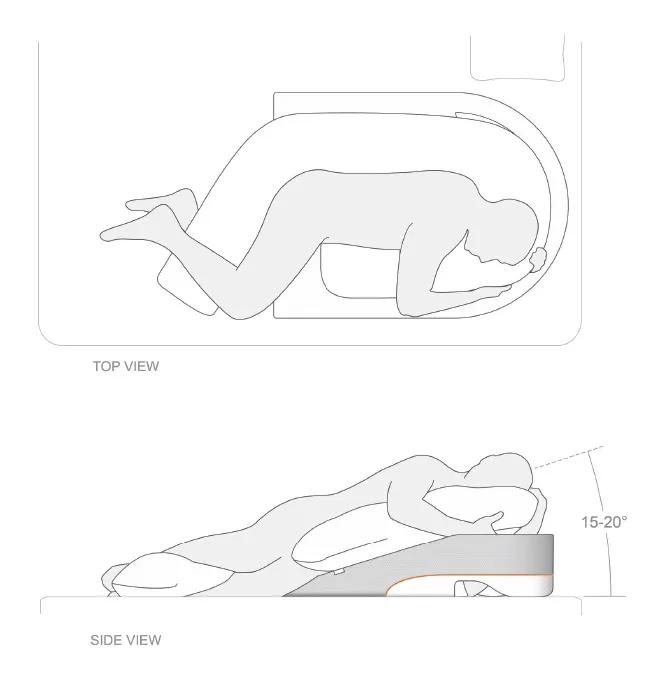 Figure 1. Illustrations show the configurations of the patient and the PTD during sleep. (Image used with permission from MedCline)
