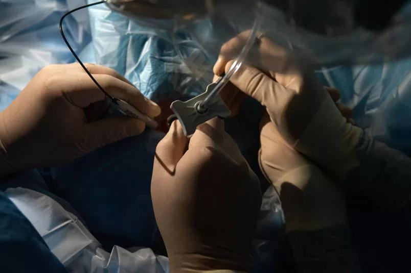 Hands of surgeons performing procedure on patient's eye