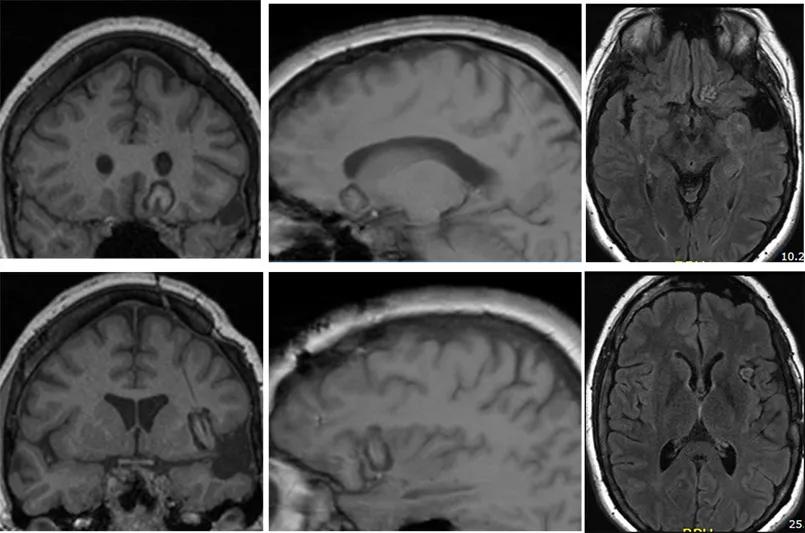 Inset Fig-5