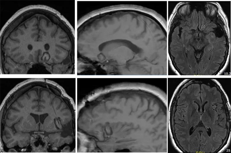 Inset Fig-5