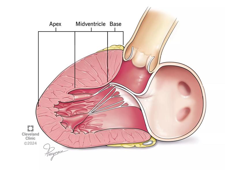 sections of the hypertrophic human heart