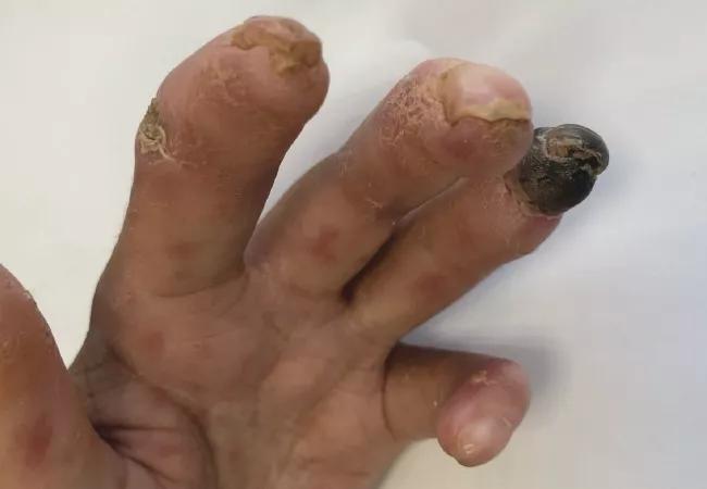 Fingers