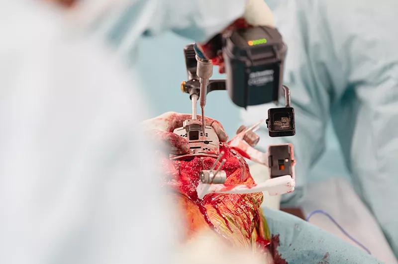 Using the augmented reality probe during surgery