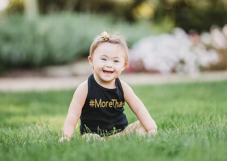 Grace down syndrome Cleveland Clinic Children's