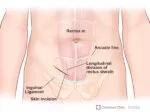 A. Skin incision and anatomic landmarks