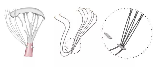 Chord-X system works