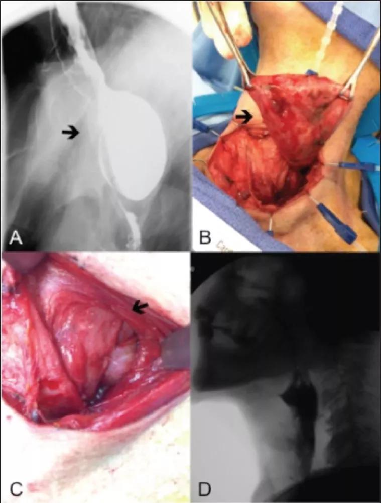 15-ENT-2836-Prendes-Consult-QD-Inset-Figure-01