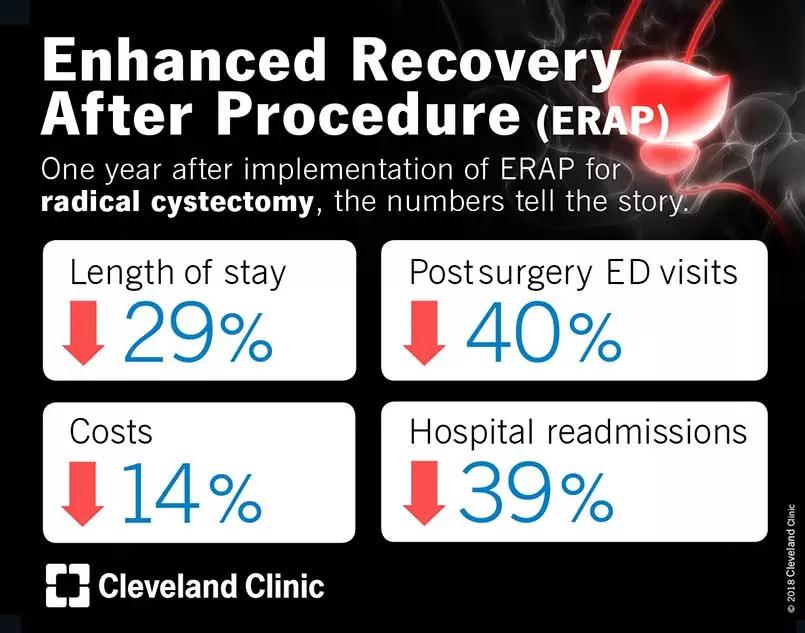 Robotic radical cystectomy proocedure