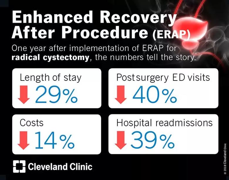 Robotic radical cystectomy proocedure