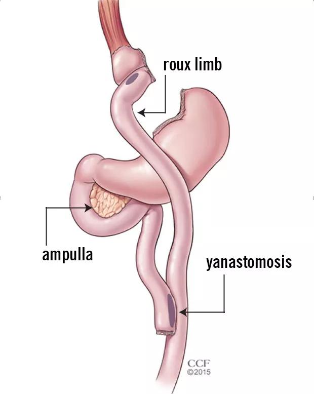 A drawing of the bile duct