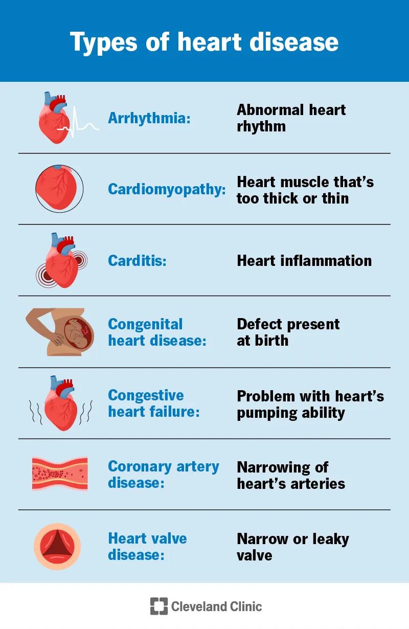 Heart disease types, including arrhythmia, cardiomyopathy, carditis, heart failure, coronary artery disease and valve disease